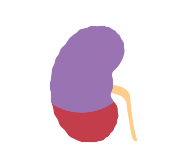 ステージ4の腎臓のイラスト